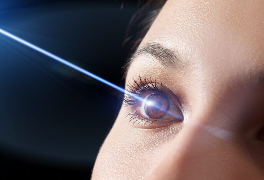Wie Augenlaser die Sehschärfe dauerhaft verbessern kann